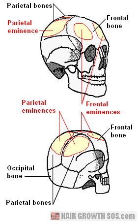 Frontal and parietal bones with frontal and parietal eminences shown