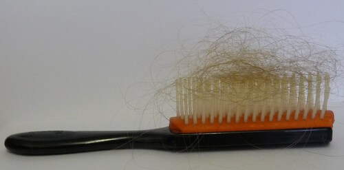 Is this a normal amount of hair loss for you? Brush with excessive amount of hair loss