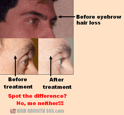 Using Copper Peptides for Hair Growth - Do They Work? Using Copper Peptides for Hair Growth - Do They Work?