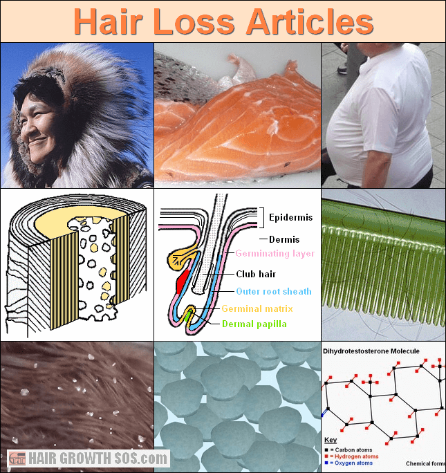 Hair loss articles by Paul Taylor