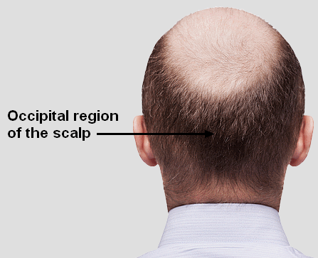 Occipital region of the scalp Occipital region of the scalp