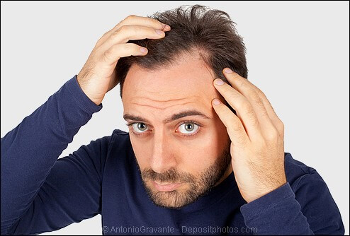 Receding Hairline? Receding Temples? Learn How and Why