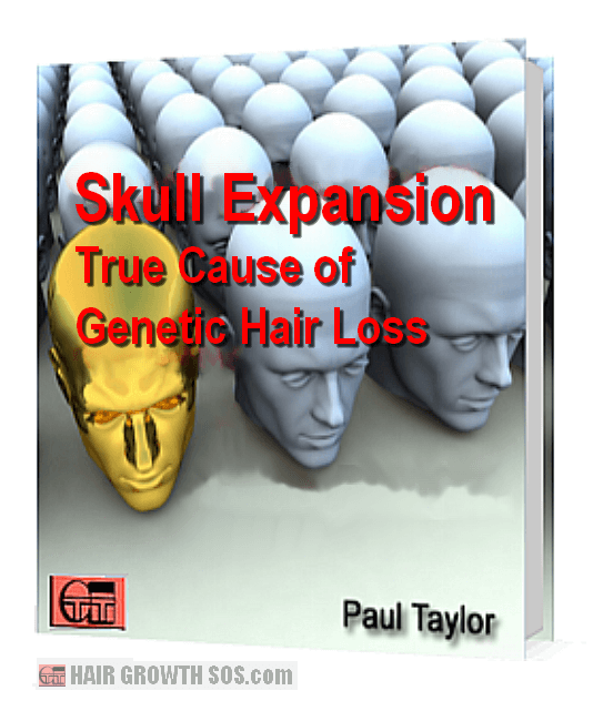 Skull expansion ebook