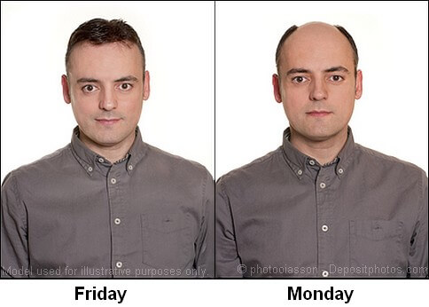 A sudden stop in using a hair loss concealer will mean a sudden change in appearance! With and without using a hair loss concealer